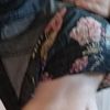 Liposuccion y lipectomia en CONCEPCIÓN 