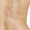 Cremas cicatrizantes post operatorias 