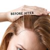 5 indicios de alopecia femenina para preocuparte 