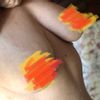 Implante mamario recomendaciones HELP