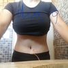 Abdominoplastia con el dr. Ruiz 