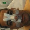 Cirugía Nasal con Doctor Changhua Lu