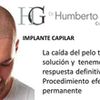 ¿CUALES SON LOS TRATAMIENTOS DE LA ALOPECIA?