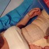 Al fin me operé! Estoy adolorida pero feliz!!!