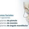 Implantes faciales contorno mandíbular 