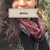 Sueño Cumplido Rinoplastia Feliz 