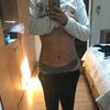 Lipo Vaser Dr. Ramírez 