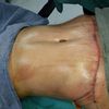 Recomendaciones 100 % Doc Marcelo Uriarte