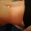 Recomendaciones 100 % Doc Marcelo Uriarte