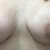 37732