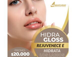 💋 Hidra Gloss - Rejuvenece tus labios por $20.000