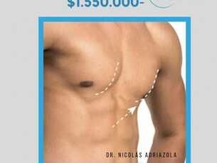 Ginecomastia ambulatoria $ 1.650.000-