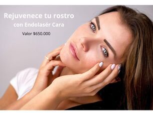 Rejuvenece tu rostro sin cirugia con Endolaser.