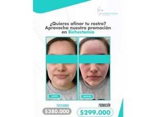🙌 Afina tu rostro!