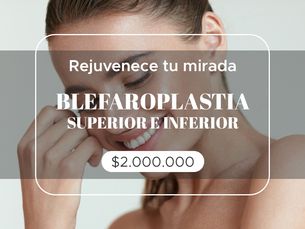 🙌 Rejuvenece tu mirada - Blefaroplastia superior e inferior a $ 2.000.000