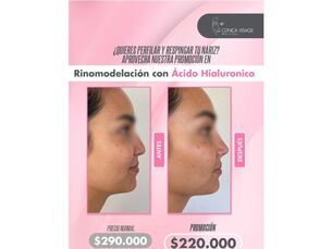 🌟 ¡Transforma tu perfil sin cirugía! 🌟