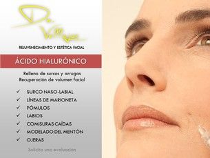 Tratamientos con Ácido hialurónico (10% descuento)