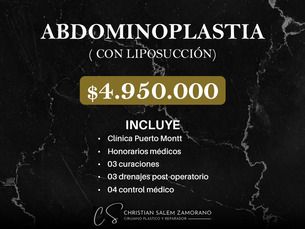 🙌 Dale forma a tu figura promoción Abdominoplastia con Liposucción.