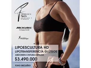 🎄 Promoción Especial Navidad - Lipoescultura HD por solo $3.490.000 🎄