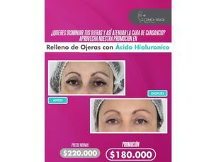 ✨ ¡Disminuye tus ojeras y atenua tu cara de cansancio ! ✨