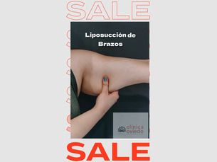 ¡Liposucción de brazos! Solo 5 cupos $ 1.099.900