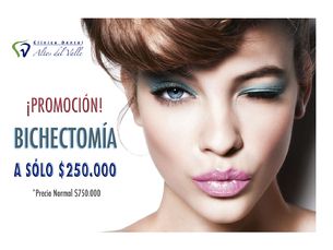 Bichectomía $250.000