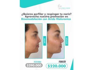 Realza tu belleza!
