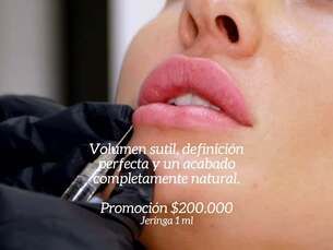 Relleno de labios con ácido hialurónico