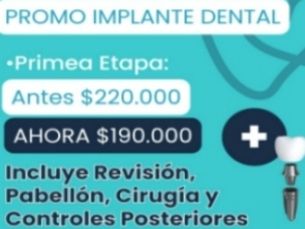 Promo Implantes Dentales