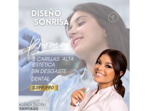 Super promoción  Diseño de Sonrisa - 📍 Santiago