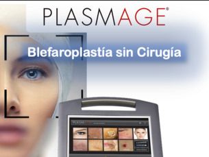Blefaroplastía Láser (sin cirugía) con Plasmage $ 450.000