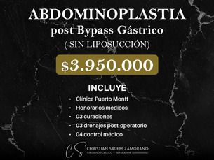 🙌 Transforma tu figura con nuestra promoción especial de Abdominoplastia