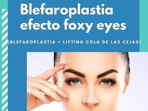 Blefaroplastia superior efecto foxy eyes $1450.000-