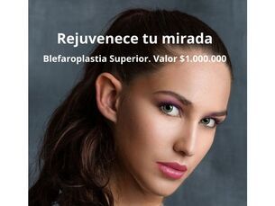 Rejuvenece tu mirada Blefaroplastia Superior por $1.000.000