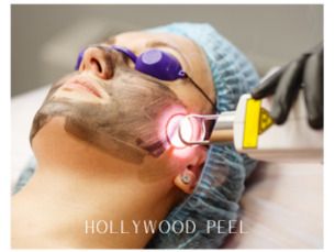 Hollywood Peel con 20% de dscto