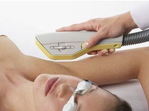 Depilación Exilite® BTL