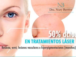 4 sesiones de tratamiento láser facial
