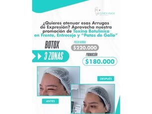 🙌 Realza tu mirada y rejuvenecce tu piel!