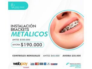 Promoción tratamiento ortodoncia brackets ahora $190.000