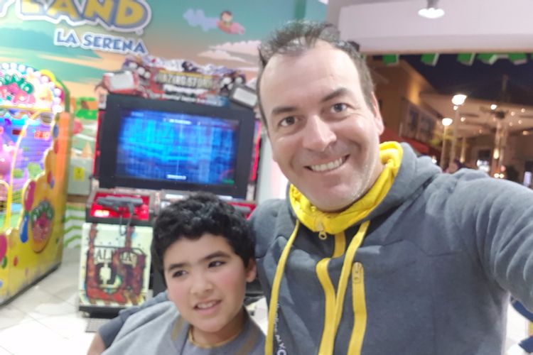 Precio por transplante capilar
