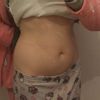Quiero una Lipo!