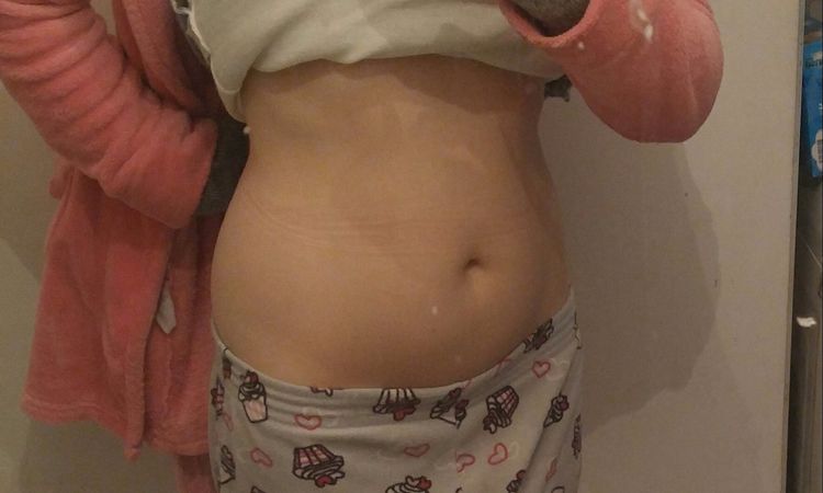 Quiero una Lipo! - 3817
