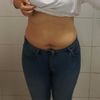 en busca de clinica para lipoescultura confiable