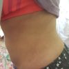 Recuperacion de grasa?