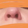 Corregir forma de Fosa nasal