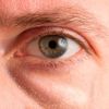 ¿Mejor tratamiento para drenar edema ojos en párpados inferiores? - 16089