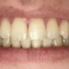 Insatisfecha con mi resultado de ortodoncia