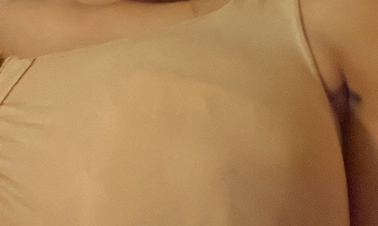 Mis pechos aún dan leche y me hice un aumento mamario - 51442
