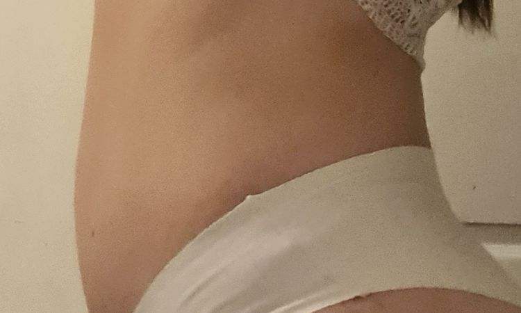 Ombligo alto tras abdominoplastia - 58808
