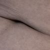 Ombligo triste post lipo